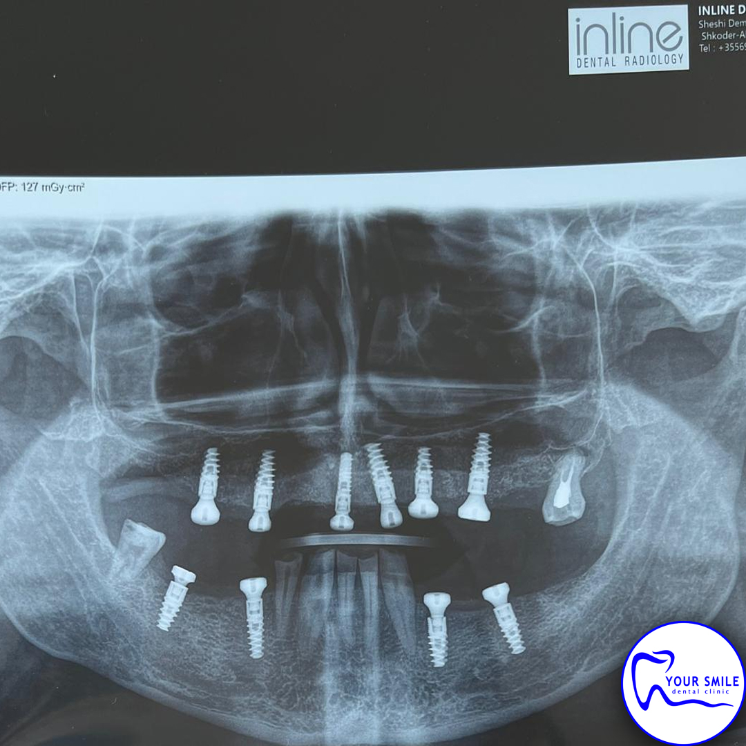 Aesthetic Dentistry