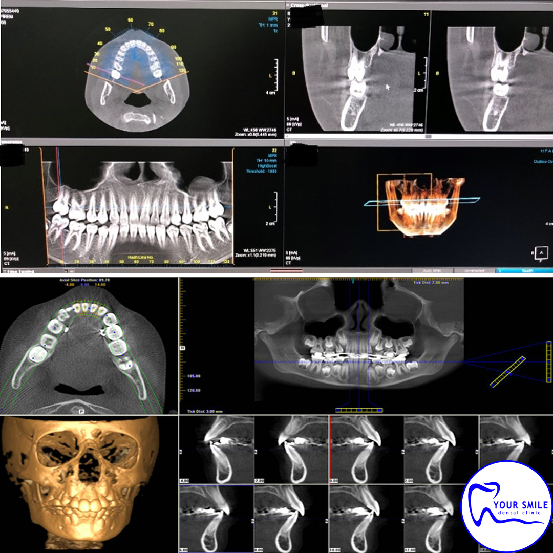 Orthodontics