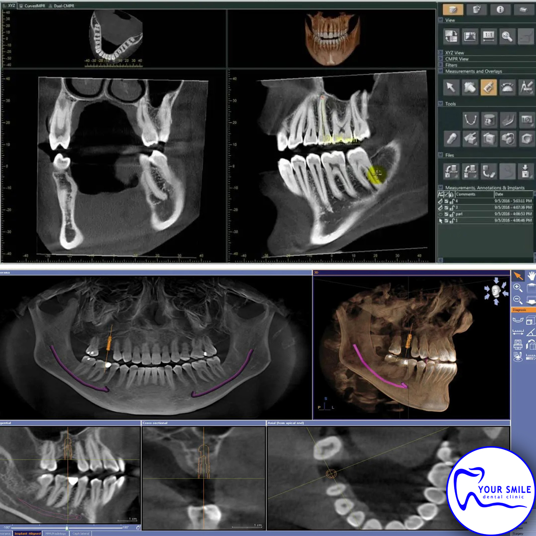 Aesthetic Dentistry