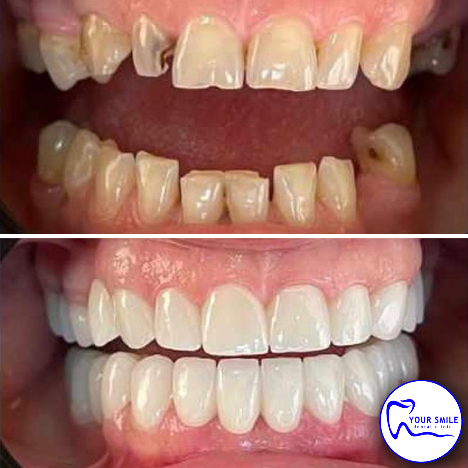 Aesthetic Dentistry