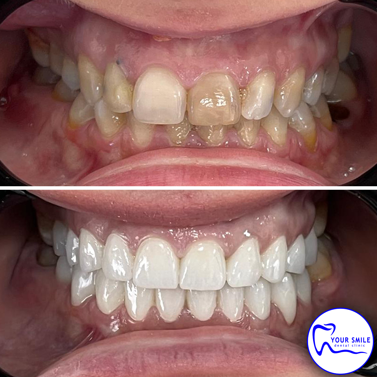 Aesthetic Dentistry