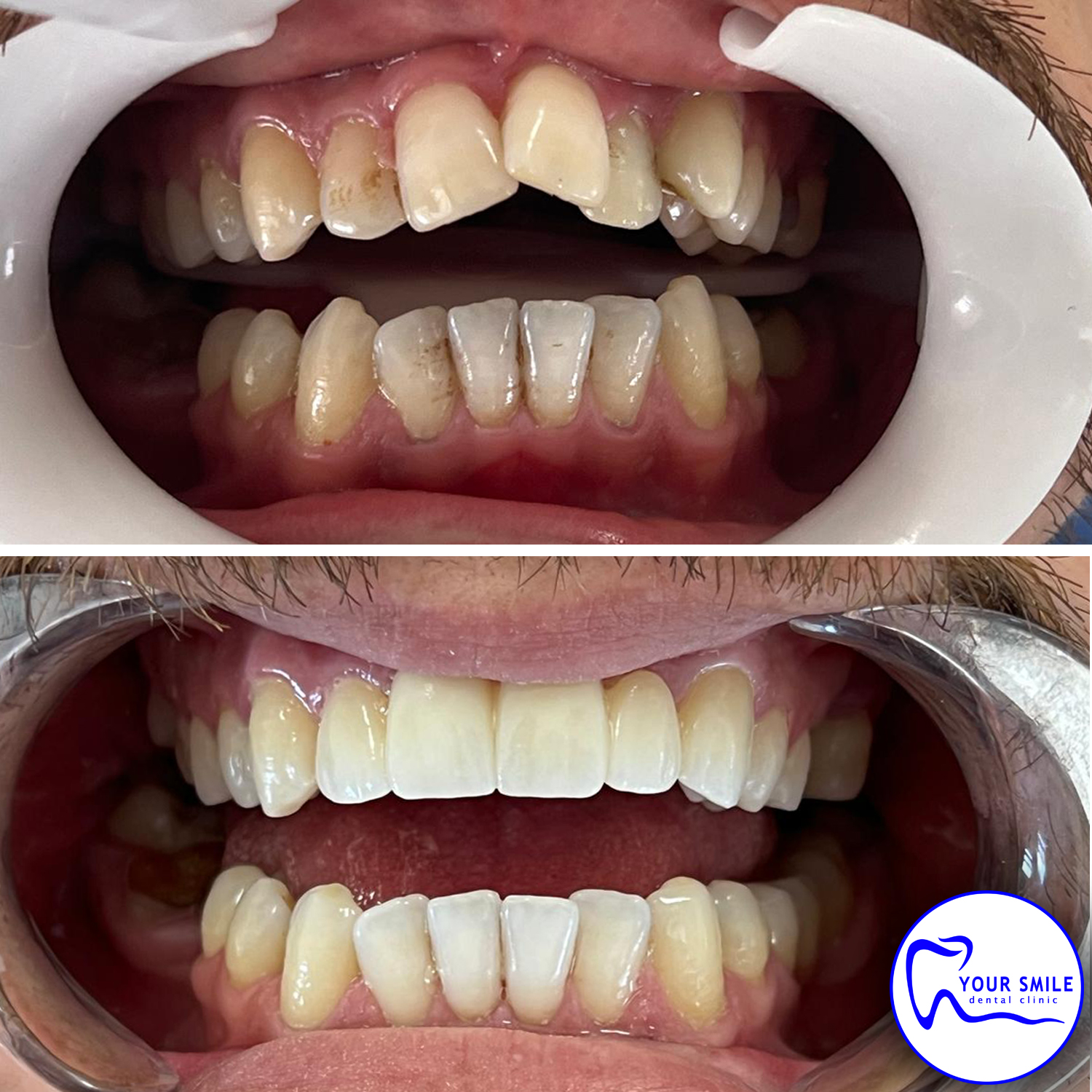 Aesthetic Dentistry