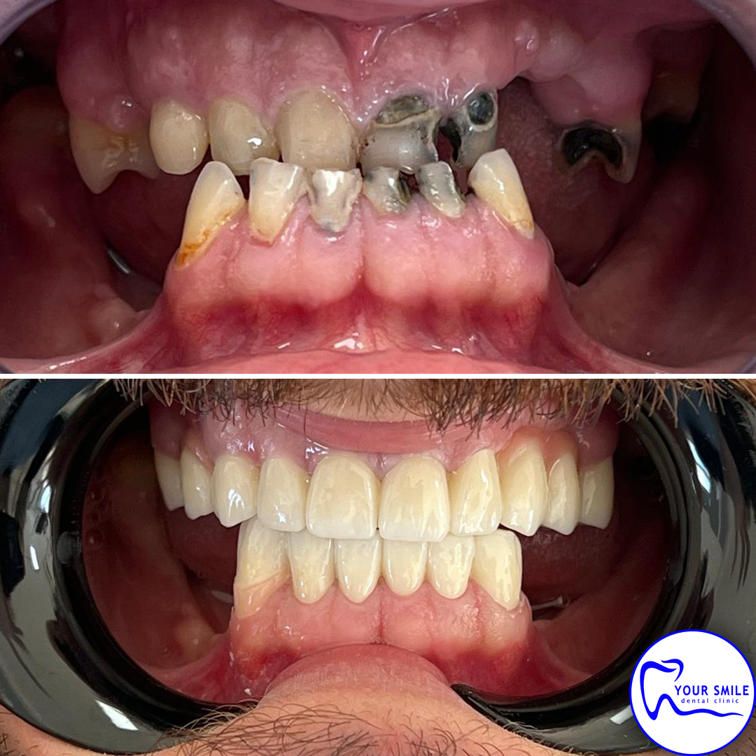 Aesthetic Dentistry
