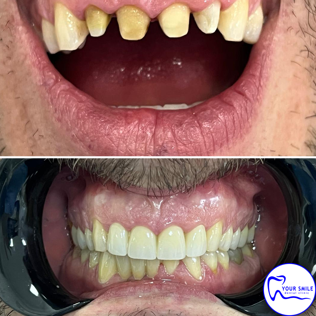 Orthodontics