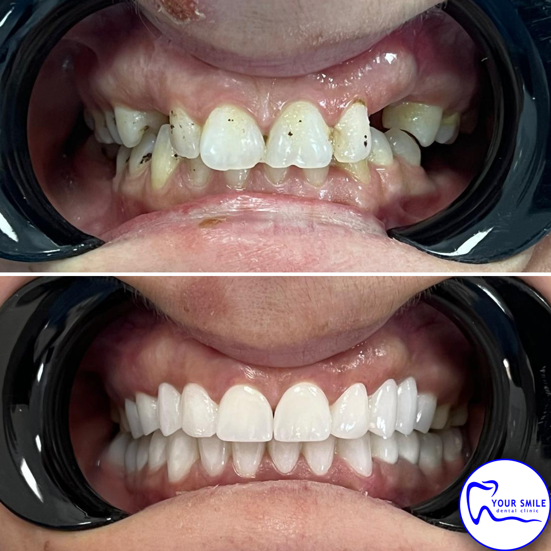 Orthodontics