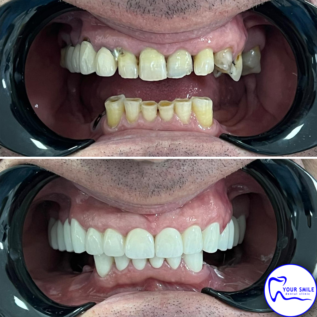 Orthodontics