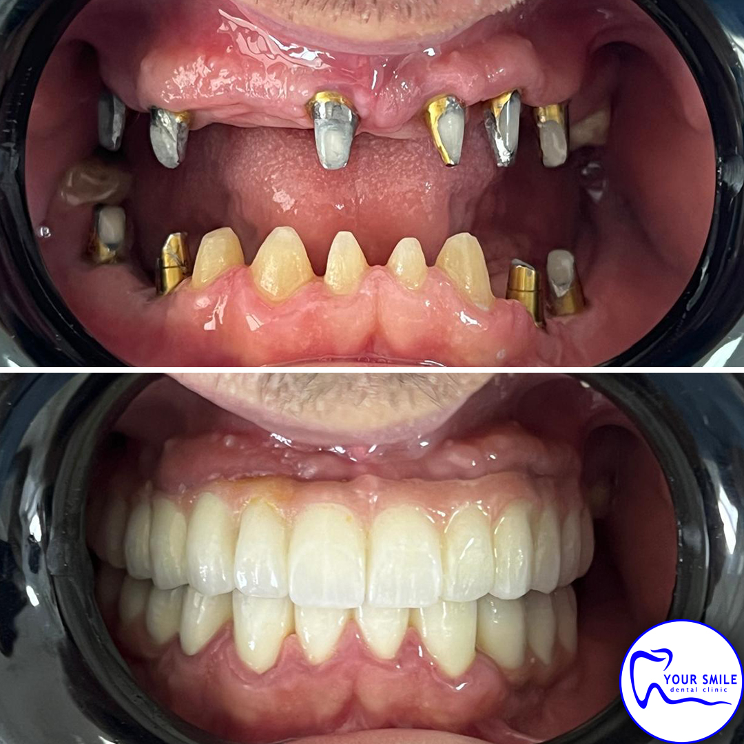 Aesthetic Dentistry