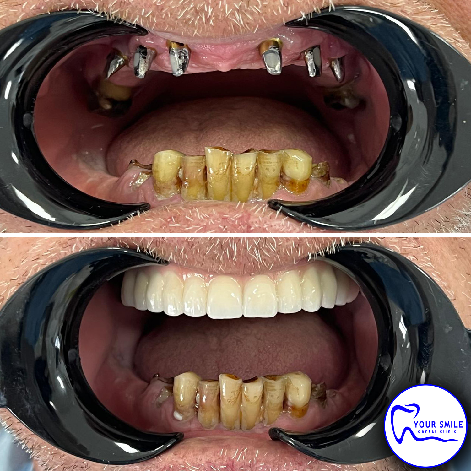 Orthodontics