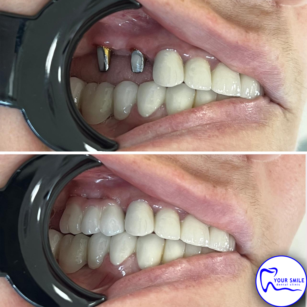 Orthodontics