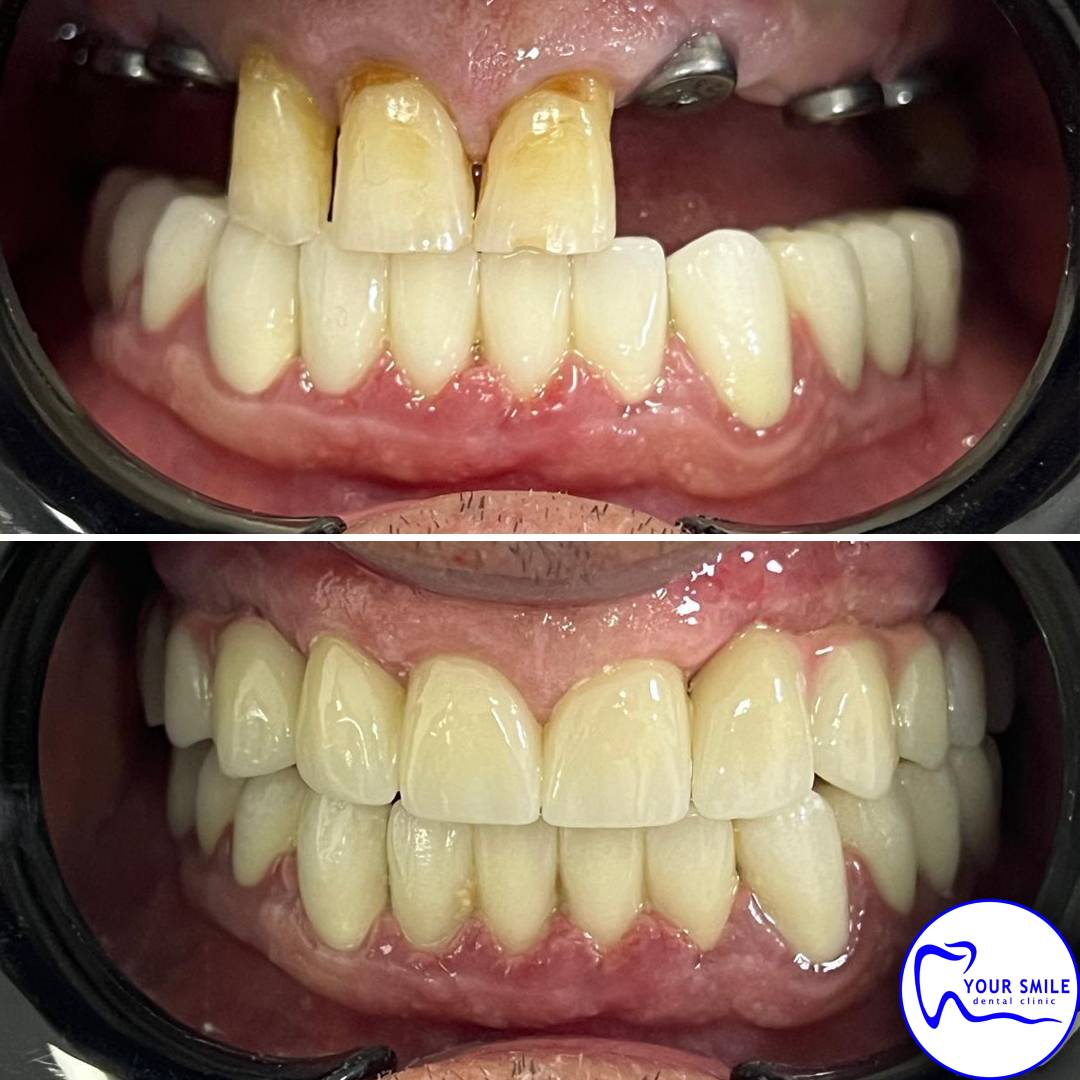 Orthodontics