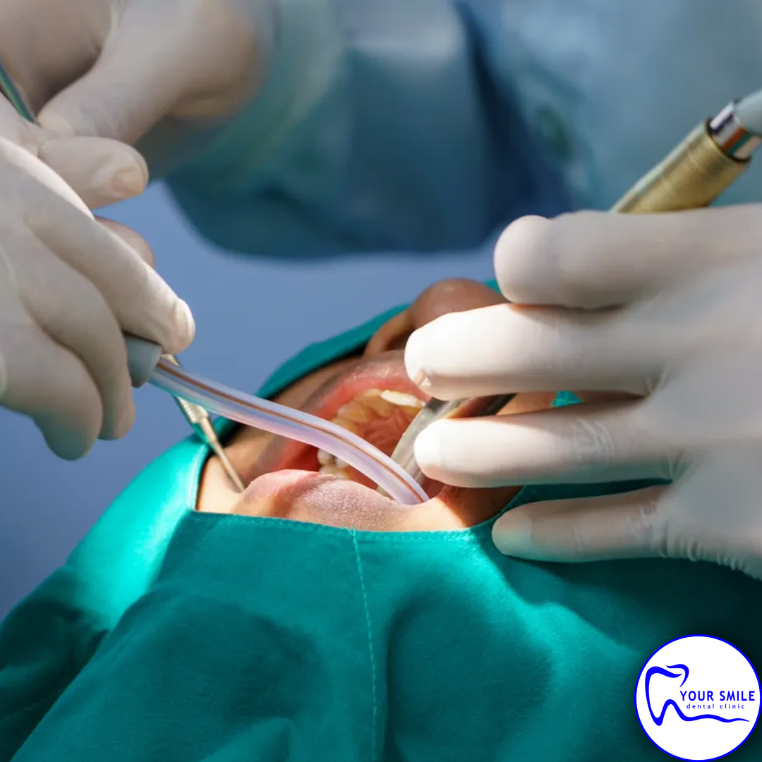Aesthetic Dentistry
