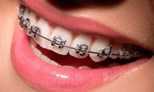 Orthodontics