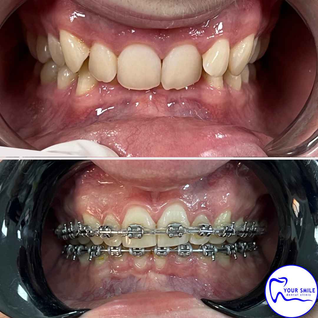 Aesthetic Dentistry