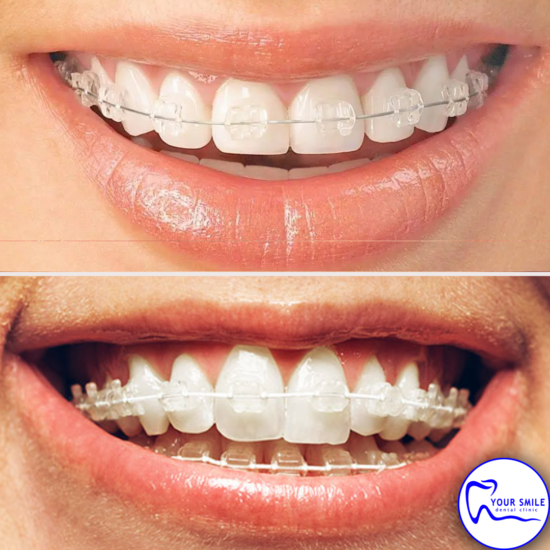 Aesthetic Dentistry