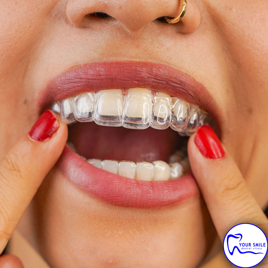 Orthodontics