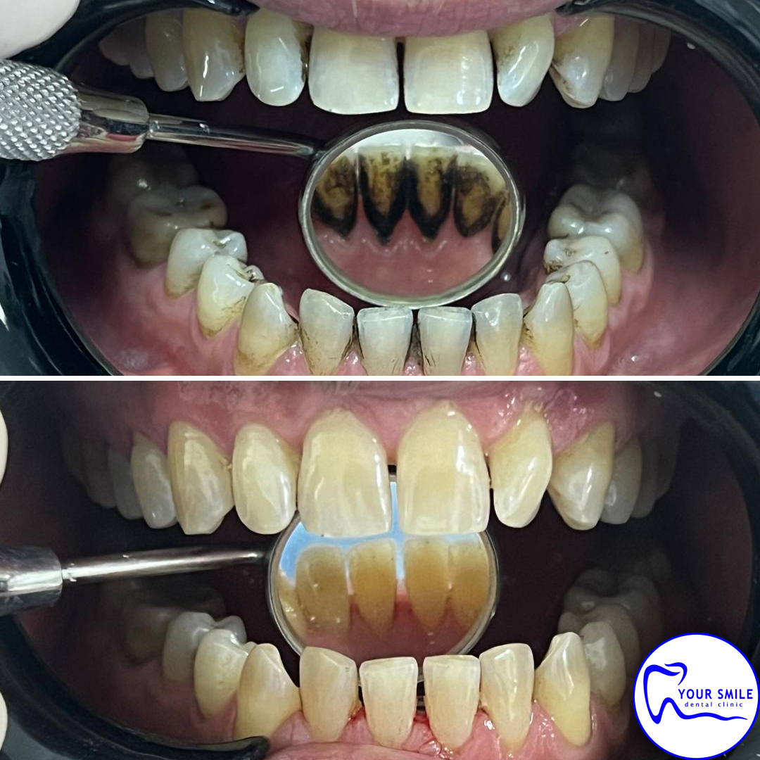 Aesthetic Dentistry