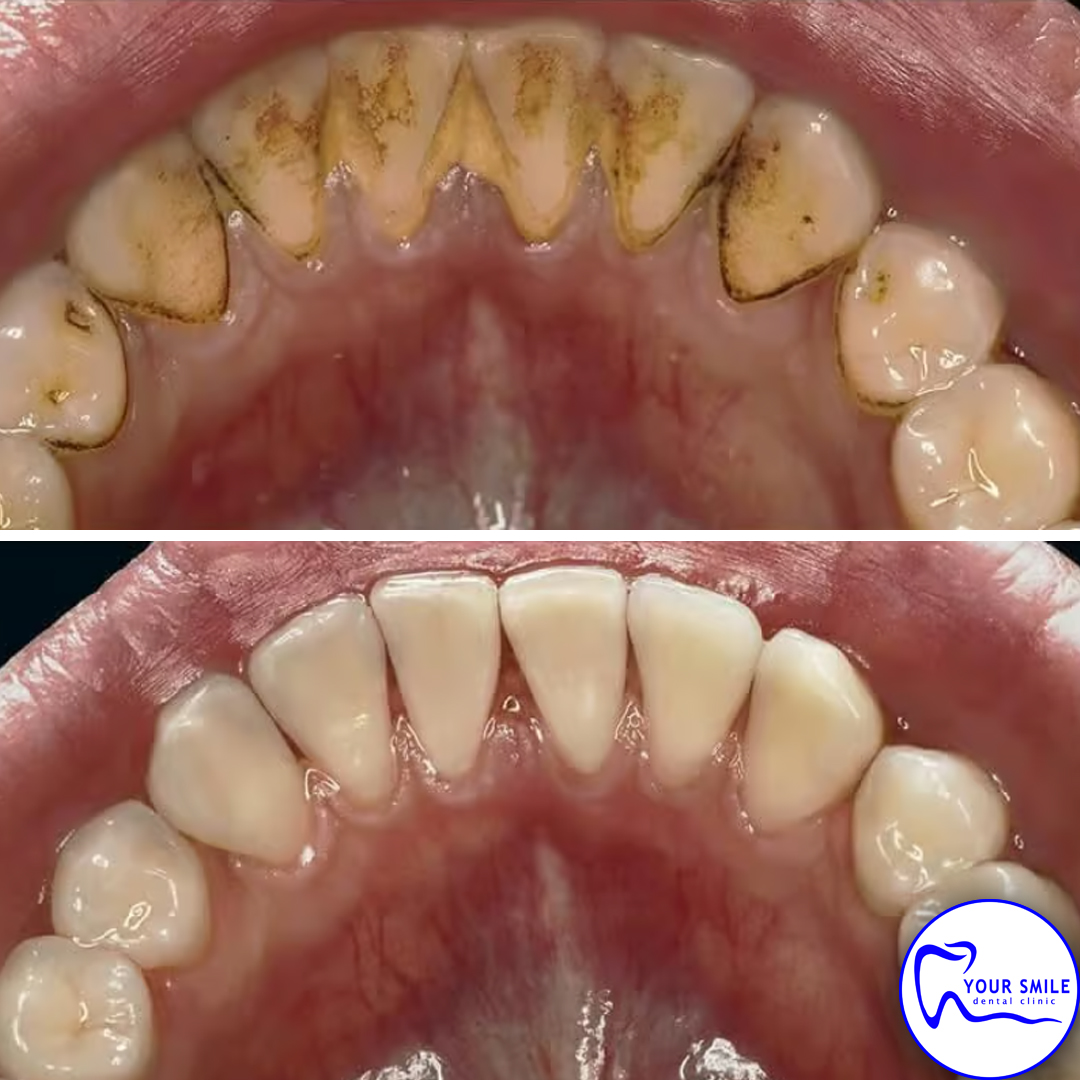 Orthodontics