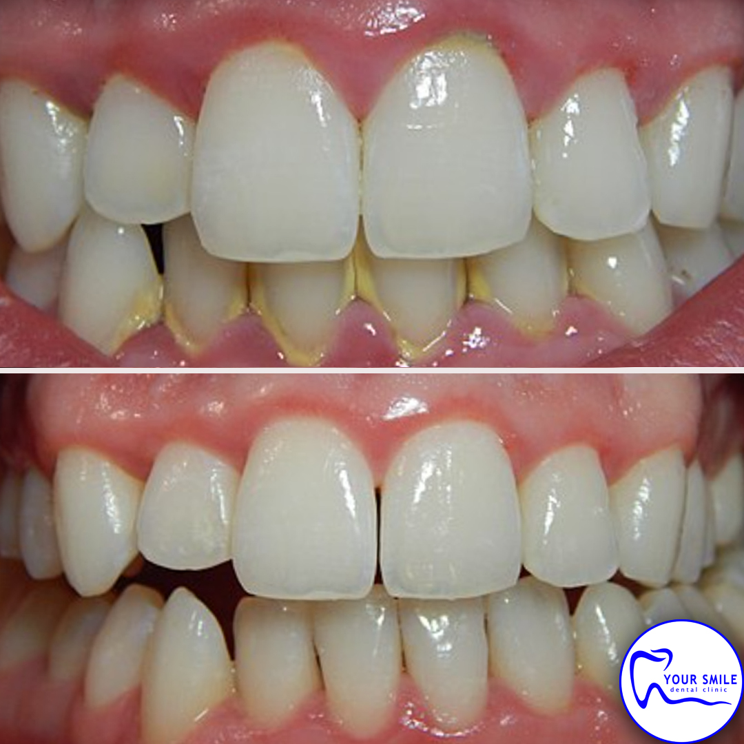 Aesthetic Dentistry