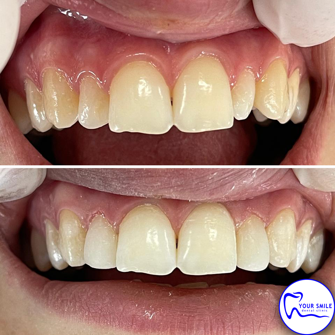 Aesthetic Dentistry
