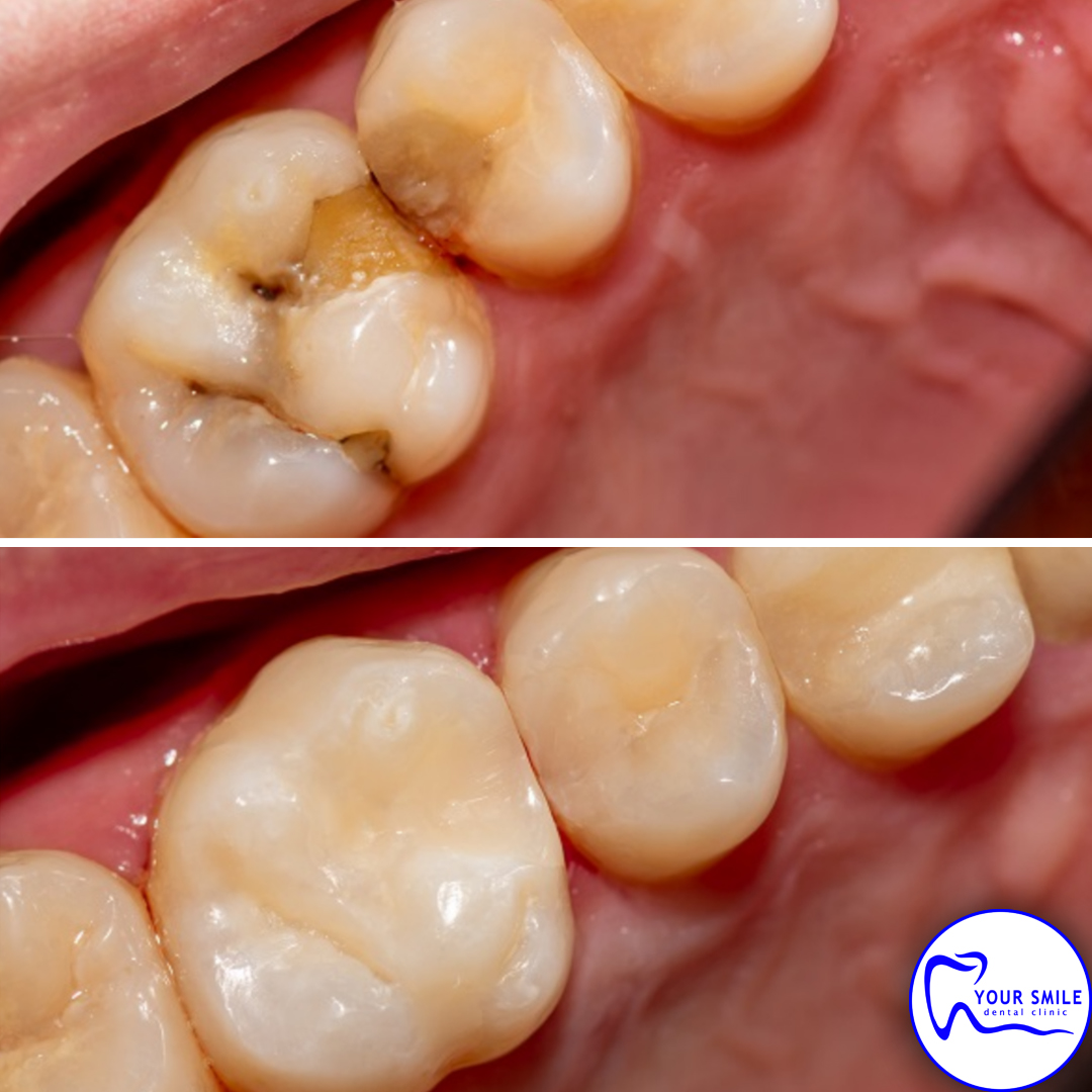 Aesthetic Dentistry
