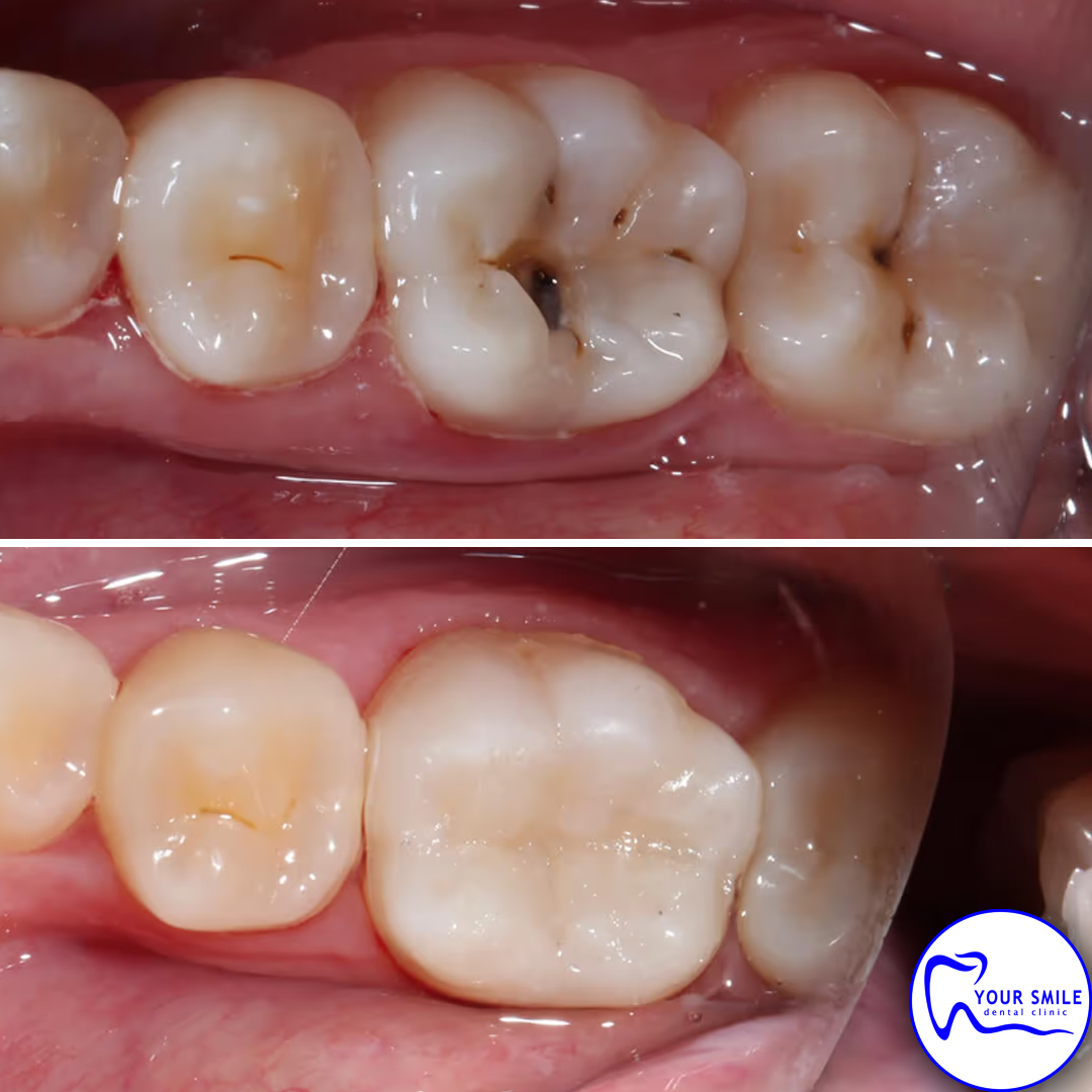 Orthodontics